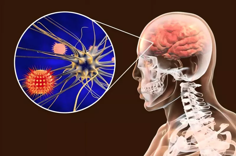 Gabay sa Bakuna sa Meningococcal